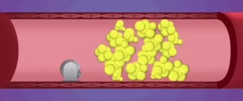 blob.png